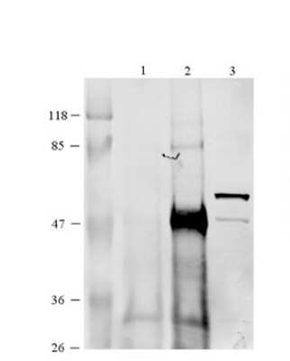 Western Blot: CCT6B Antibody [NBP1-56939] - 293T cells lysate, Antibody Titration: 1 ug/ml