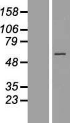 Western Blot: CCT6B Overexpression Lysate (Adult Normal) [NBL1-08902] Left-Empty vector transfected control cell lysate (HEK293 cell lysate); Right -Over-expression Lysate for CCT6B.