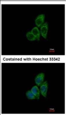 Immunocytochemistry/Immunofluorescence: CCT8 Antibody [NBP2-15770] - Immunofluorescence analysis of methanol-fixed A431, using antibody at 1:500 dilution.