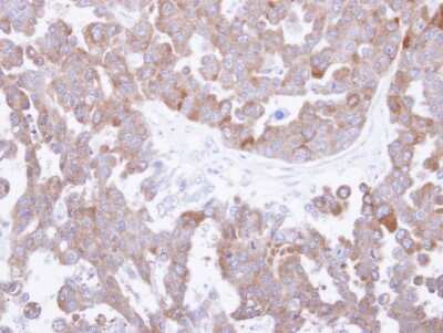 Immunohistochemistry-Paraffin: CCT8 Antibody [NBP1-33486] - Paraffin-embedded OVCAR3 xenograft, using antibody at 1:500 dilution.