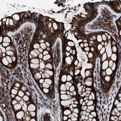 Immunohistochemistry-Paraffin: CCT8 Antibody [NBP1-88286] - Staining of human colon shows strong cytoplasmic positivity in glandular cells.