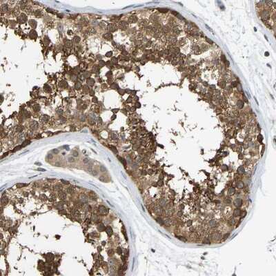 Immunohistochemistry-Paraffin: CCT8 Antibody [NBP1-88287] - Staining of human testis shows strong cytoplasmic positivity in cells in seminiferus ducts.