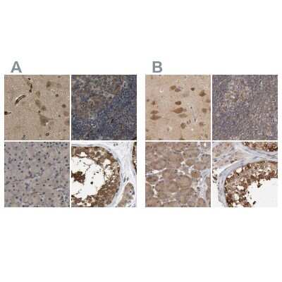 <b>Independent Antibodies Validation. </b>Immunohistochemistry-Paraffin: CCT8 Antibody [NBP1-88287] - Staining of human cerebral cortex, lymph node, pancreas and testis using Anti-CCT8 antibody NBP1-88287 (A) shows similar protein distribution across tissues to independent antibody NBP1-88285 (B).