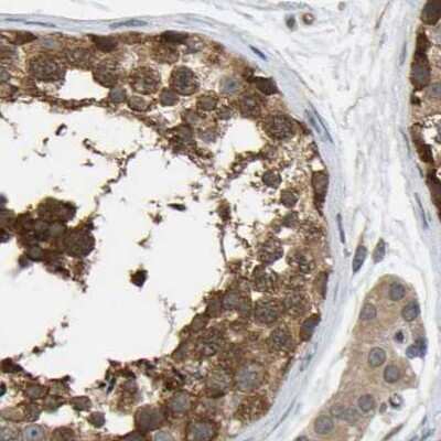 Immunohistochemistry-Paraffin: CCT8 Antibody [NBP1-88287] - Staining of human testis.