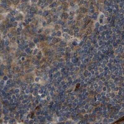 <b>Independent Antibodies Validation. </b>Immunohistochemistry-Paraffin: CCT8 Antibody [NBP1-88287] - Staining of human lymph node.