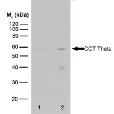 Western Blot: CCT8 Antibody (PK/13/72/8k) [NB100-66596] - Western blot analysis of HeLa whole cell lysate and HeLa heat stressed whole cell lysate probed with RAT ANTI CCT THETA followed by F2 Rabbit anti Rat IgG:HRP