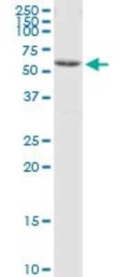 Western Blot: CCT8 Antibody [H00010694-B02P] - Analysis of CCT8 expression in Jurkat.