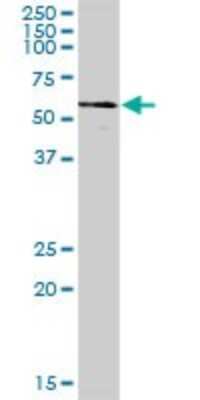Western Blot: CCT8 Antibody [H00010694-B02P] - Analysis of CCT8 expression in human spleen.