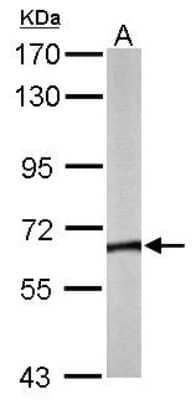 Western Blot: CCT8 Antibody [NBP1-33486] - Sample (50 ug of whole cell lysate) A: Mouse brain 7. 5% SDS PAGE; antibody diluted at 1:5000.