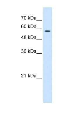 Western Blot: CCT8 Antibody [NBP1-56608] - Sample Type: HEK 293 (10ug) Primary Dilution: 1:1000 Secondary Antibody: conjugated goat anti-rabbit Secondary Dilution: 1:10,000 Image Submitted By: Amy Gray Brigham Young University