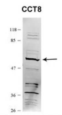 Western Blot: CCT8 Antibody [NBP1-56608] - C-terminal region validated by WB using HEK 293T at 1:1,000 dilution for antibody samples and 1:10,000 for secondary antibodies.