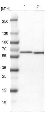 Western Blot: CCT8 Antibody [NBP1-88286] - Lane 1: NIH-3T3 cell lysate (Mouse embryonic fibroblast cells). Lane 2: NBT-II cell lysate (Rat Wistar bladder tumor cells).