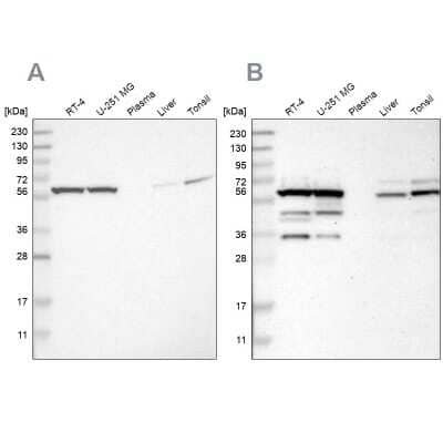 Western Blot: CCT8 Antibody [NBP1-88286] - Analysis using Anti-CCT8 antibody NBP1-88286 (A) shows similar pattern to independent antibody NBP1-88287 (B).