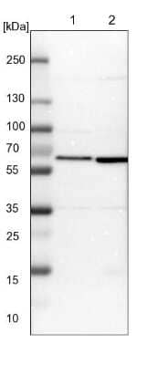 Western Blot: CCT8 Antibody [NBP1-88287] - Lane 1: NIH-3T3 cell lysate (Mouse embryonic fibroblast cells). Lane 2: NBT-II cell lysate (Rat Wistar bladder tumor cells).