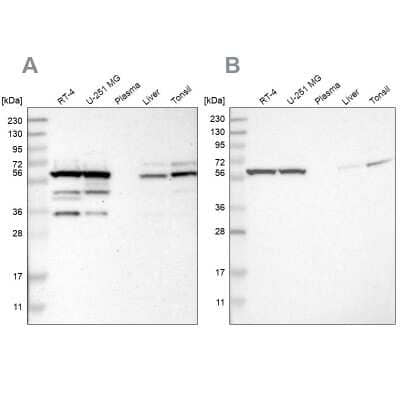 Western Blot: CCT8 Antibody [NBP1-88287] - Analysis using Anti-CCT8 antibody NBP1-88287 (A) shows similar pattern to independent antibody NBP1-88286 (B).