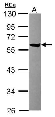 Western Blot: CCT8 Antibody [NBP2-15770] - Sample (30 ug of whole cell lysate) A: Raji 10% SDS PAGE gel, diluted at 1:10000.