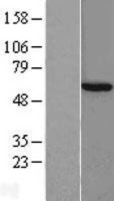 Western Blot CCT8 Overexpression Lysate