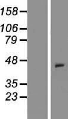 Western Blot: CCXCR1 Overexpression Lysate (Adult Normal) [NBP2-11040] Left-Empty vector transfected control cell lysate (HEK293 cell lysate); Right -Over-expression Lysate for CCXCR1.