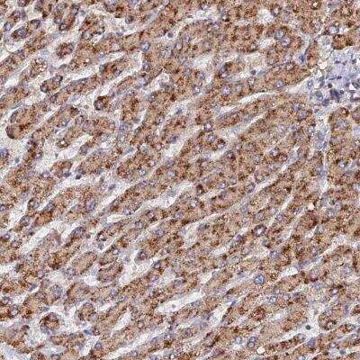 Immunohistochemistry-Paraffin: CCZ1 Antibody [NBP2-46711] - Staining of human liver shows strong cytoplasmic positivity in hepatocytes.