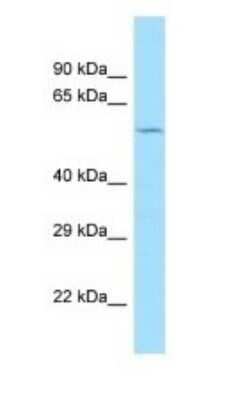 Western Blot: CCZ1 Antibody [NBP1-98558] - Titration: 1.0 ug/ml Positive Control: 293T Whole Cell.