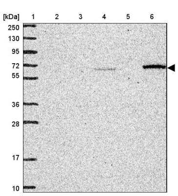Western Blot: CCZ1 Antibody [NBP2-46780] - Lane 1: Marker  [kDa] 250, 130, 95, 72, 55, 36, 28, 17, 10, Lane 2: Human cell line RT-4, Lane 3: Human cell line U-251 MG, Lane 4: Human plasma, Lane 5: Human Analysis of human liver tissue., Lane 6: Human Tonsil tissue