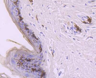 Immunohistochemistry-Paraffin: CD1 Antibody (JM21-33) [NBP2-67222] - Analysis of paraffin-embedded human skin tissue using anti-CD1a antibody. Counter stained with hematoxylin.