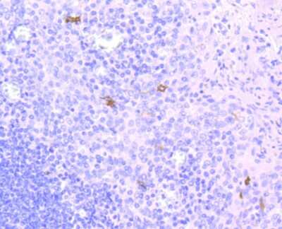 Immunohistochemistry-Paraffin: CD1 Antibody (JM21-33) [NBP2-67222] - Analysis of paraffin-embedded human tonsil tissue using anti-CD1a antibody. Counter stained with hematoxylin.