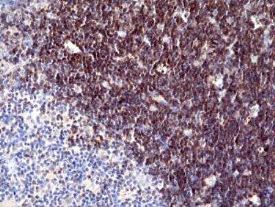 Immunohistochemistry-Paraffin: CD1 Antibody (RM393) [NBP2-89087] - Immunohistochemical staining of formalin fixed and paraffin embedded human thymus tissue section using anti-CD1a rabbit monoclonal antibody (Clone RM393) at a 1:100 dilution.