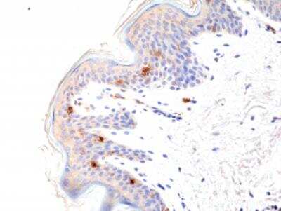 Immunohistochemistry-Paraffin: CD1 Antibody (RM393) [NBP2-89087] - Immunohistochemical staining of formalin fixed and paraffin embedded human skin tissue section using anti-CD1a rabbit monoclonal antibody (Clone RM393) at a 1:100 dilution.