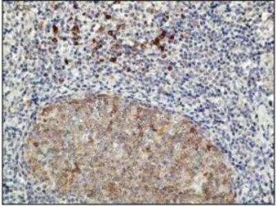 Immunohistochemistry-Paraffin: CD10 Antibody (E19-P) [NBP1-78996] - Formalin-fixed and paraffin-embedded human tonsil tissue (4 um) stained with anti-CD10 antibody shows positive immunostaining of germinal centre cells.Kindly performed and provided by Katarina Poliakova, MD and Lubomir Straka, MD, Ph. D. from Clinical Pathology Presov, Ltd., Presov, Slovak republic.