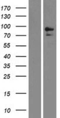 Western Blot Neprilysin/CD10 Overexpression Lysate