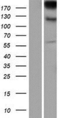 Western Blot: CD103/Integrin alpha E Overexpression Lysate (Native) [NBP2-10814] - CD103/Integrin alpha E Overexpression Lysate (Native) Left-Empty vector transfected control cell lysate (HEK293 cell lysate); Right -Over-expression Lysate for Integrin alpha E.