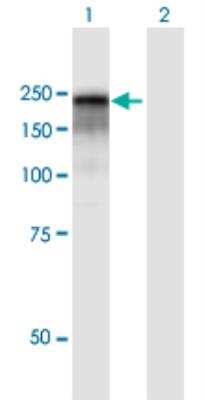 Western Blot: CD109 Antibody [H00135228-B01P-50ug] - Western Blot analysis of CD109 expression in transfected 293T cell line (H00135228-T01) by CD109 MaxPab polyclonal antibody.Lane 1: CD109 transfected lysate(158.95 kDa).Lane 2: Non-transfected lysate