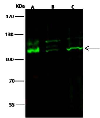 Western Blot: CD117/c-kit Antibody (017) [NBP2-90624] - Anti-CD117/c-kit rabbit monoclonal antibody at 1:500 dilution. Lane A: MOLT4 Whole Cell Lysate. Lane B: Jurkat Whole Cell Lysate. Lane C: K562 Whole Cell Lysate. Lysates/proteins at 30 ug per lane. Secondary Goat Anti-Rabbit IgG H&L (Dylight 800) at 1/10000 dilution. Developed using the Odyssey technique. Performed under reducing conditions. Predicted band size: 110 kDa. Observed band size: 110 kDa (We are unsure as to the identity of these extra bands).