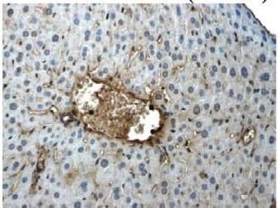 Immunohistochemistry: CD117/c-kit Antibody (9D2) [NB110-93600] - Staining of paraffin sections of mouse kidney and liver tissues from LPS exposed animals.