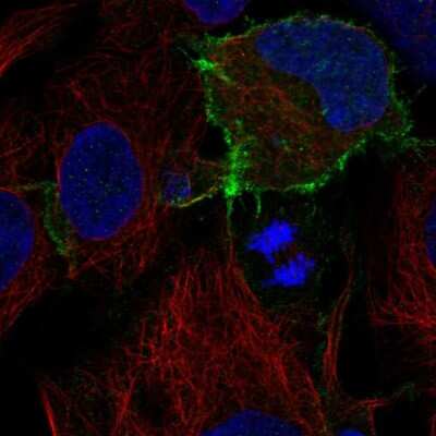 Immunocytochemistry/Immunofluorescence: CD117/c-kit Antibody [NBP2-57890] - Staining of human cell line HEK 293 shows localization to plasma membrane. Antibody staining is shown in green. 