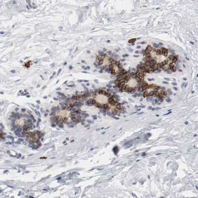 Immunohistochemistry-Paraffin: CD117/c-kit Antibody [NBP1-85593] - Staining of human breast shows high expression.