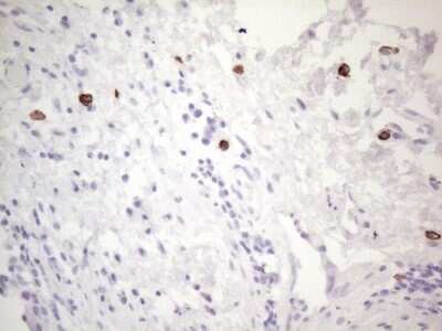 Immunohistochemistry: CD117/c-kit Antibody (OTI2B12) - Azide and BSA Free [NBP2-71076] - Analysis of Human bladder tissue. (Heat-induced epitope retrieval by 1mM EDTA in 10mM Tris buffer (pH8.5) at 120C for 3 min)(1:150)