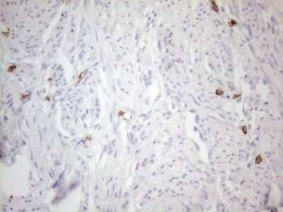 Immunohistochemistry: CD117/c-kit Antibody (OTI2B12) - Azide and BSA Free [NBP2-71076] - Analysis of Human endometrium tissue. (Heat-induced epitope retrieval by 1mM EDTA in 10mM Tris buffer (pH8.5) at 120C for 3 min)