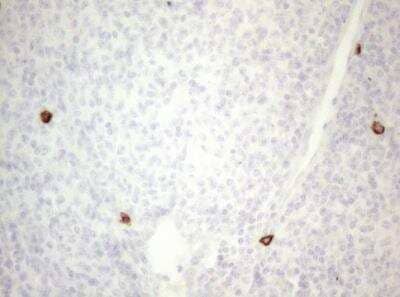 Immunohistochemistry-Paraffin: CD117/c-kit Antibody (OTI2B12) - Azide and BSA Free [NBP2-71076] - Staining of  Human lymphoma tissue using anti-KIT mouse monoclonal antibody. (Heat-induced epitope retrieval by 1mM EDTA in 10mM Tris buffer (pH8.5) at 120 degrees C for 3min.