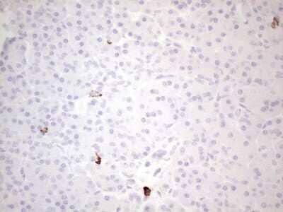 Immunohistochemistry-Paraffin: CD117/c-kit Antibody (OTI2B12) - Azide and BSA Free [NBP2-71076] - Analysis of Human pancreas tissue. (Heat-induced epitope retrieval by 1mM EDTA in 10mM Tris buffer (pH8.5) at 120C for 3 min)