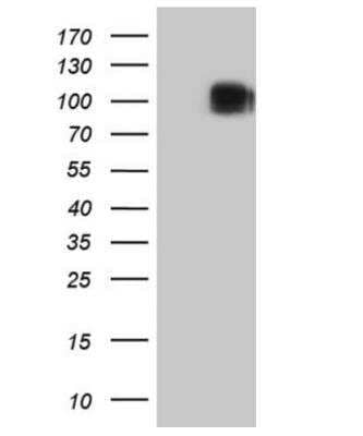 Western Blot: CD117/c-kit Antibody (OTI2B12) - Azide and BSA Free [NBP2-71076] - HEK293T cells were transfected with the pCMV6-ENTRY control (Left lane) or pCMV6-ENTRY KIT ( Right lane) cDNA for 48 hrs and lysed. Equivalent amounts of cell lysates (5 ug per lane) were separated by SDS-PAGE and immunoblotted with anti-KIT (1:2000). Positive lysates.