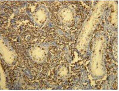 Immunohistochemistry-Paraffin: CD117/c-kit Antibody (R21-V) [NBP1-79010] - Membranous CD117 positivity in the classical seminoma. Formalin fixed, paraffin embedded human tissues (4 um sections) stained with anti-CD117 monospecific clonal antibody.