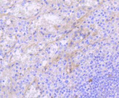 Immunohistochemistry-Paraffin: CD117/c-kit Antibody (ST04-99) [NBP2-67531] - Analysis of paraffin-embedded human spleen tissue using anti-c-Kit antibody. Counter stained with hematoxylin.