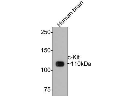 Western Blot: CD117/c-kit Antibody (ST04-99) [NBP2-67531] - Analysis of CD117/c-Kit on human brain tissue lysates with Rabbit anti-CD117/c-Kit antibody at 1/500 dilution. Lysates/proteins at 20 ug/Lane. Predicted band size: 110 kDa Observed band size: 110 kDa Exposure time: 2 minutes; 6% SDS-PAGE gel. Proteins were transferred to a PVDF membrane and blocked with 5% NFDM/TBST for 1 hour at room temperature. The primary antibody at 1/500 dilution was used in 5% NFDM/TBST at room temperature for 2 hours. Goat Anti-Rabbit IgG - HRP Secondary Antibody at 1:300,000 dilution was used for 1 hour at room temperature.