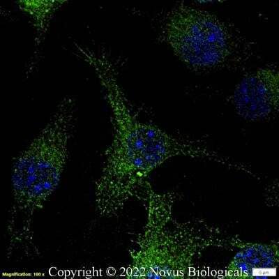 Immunocytochemistry/Immunofluorescence: CD11b Antibody [Alexa Fluor® 488] [NB110-89474AF488] - Raw264.7 cells were fixed in 4% paraformaldehyde for 10 minutes and permeabilized in 0.05% Triton X-100 in PBS for 5 minutes. The cells were incubated with CD11b Antibody conjugated to Alexa Fluor 488 (NB110-89474AF488) at 5 ug/ml for 1 hour at room temperature. Nuclei were counterstained with DAPI (Blue). Cells were imaged using a 100X objective and digitally deconvolved.