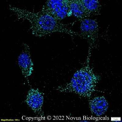 Immunocytochemistry/Immunofluorescence: CD11b Antibody [Alexa Fluor® 647] [NB110-89474AF647] - Raw264.7 cells were fixed in 4% paraformaldehyde for 10 minutes and permeabilized in 0.05% Triton X-100 in PBS for 5 minutes. The cells were incubated with CD11b Antibody conjugated to Alexa Fluor 647 (NB110-89474AF647) at 5 ug/ml for 1 hour at room temperature. Nuclei were counterstained with DAPI (Blue). Cells were imaged using a 100X objective and digitally deconvolved.