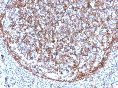 Immunohistochemistry-Paraffin: CD11b Antibody (ITGAM/3340) - Azide and BSA Free [NBP2-34573] - Formalin-fixed, paraffin-embedded human tonsil stained with Monocpecific Mouse Monoclonal CD11b Antibody (ITGAM/3340) [NBP2-34573].