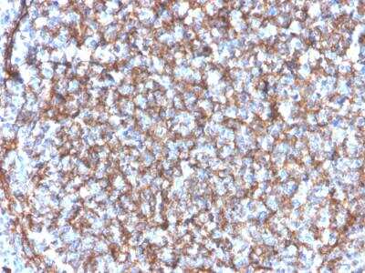 Immunohistochemistry-Paraffin: CD11b Antibody (ITGAM/3340) - Azide and BSA Free [NBP2-34573] - Formalin-fixed, paraffin-embedded human tonsil stained with Monospecific Mouse Monoclonal CD11b Antibody (ITGAM/3340) [NBP2-34573].