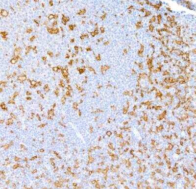 Immunohistochemistry: CD11c Antibody (BLR138H) [NBP3-14718] -  Rabbit anti-CD11c recombinant monoclonal antibody.  HRP-conjugated goat anti-rabbit IgG.